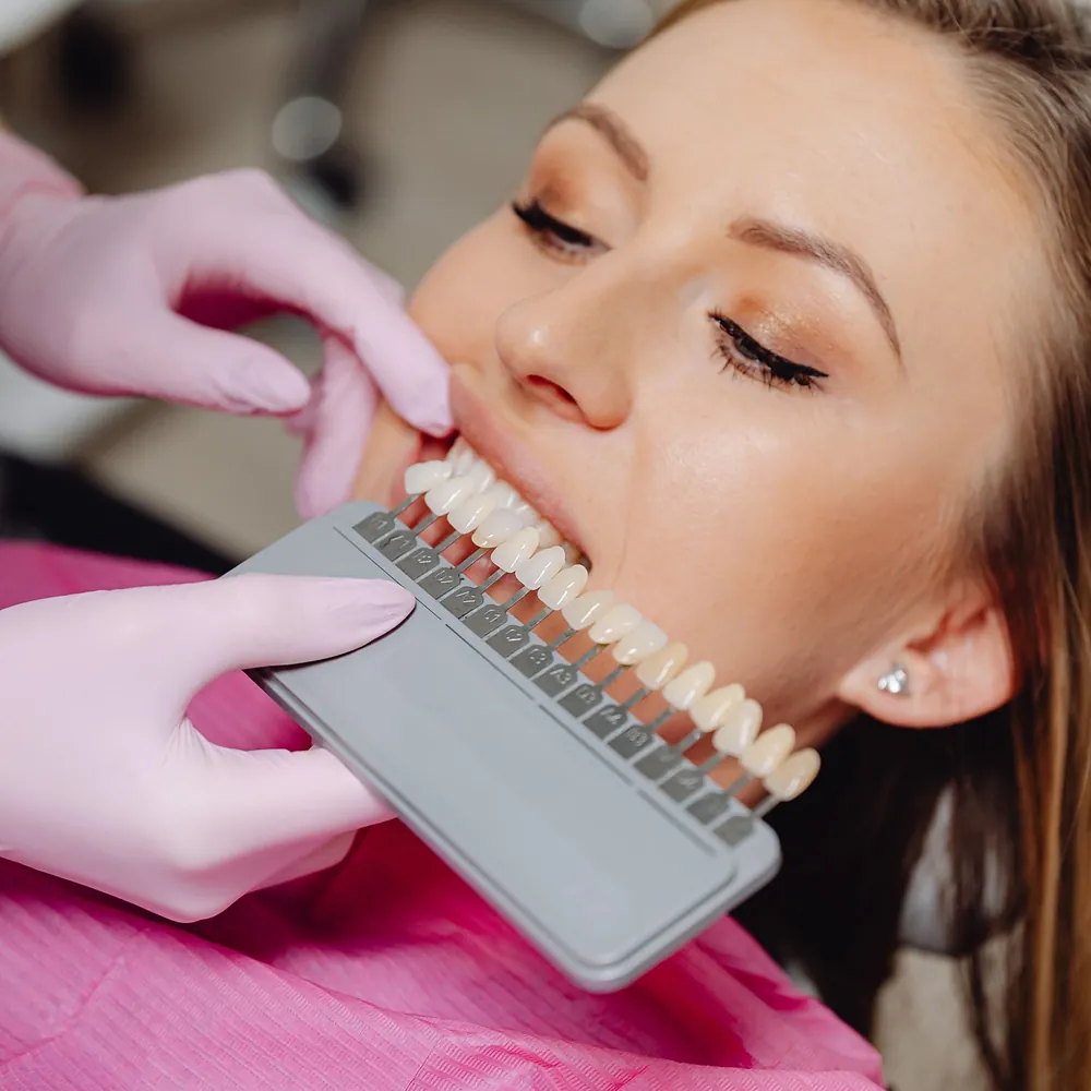 La guía de colores apoyada contra los dientes para elegir el tono
