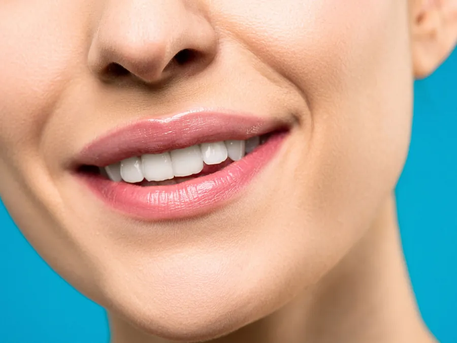 Primer plano de una sonrisa con los dientes parejos